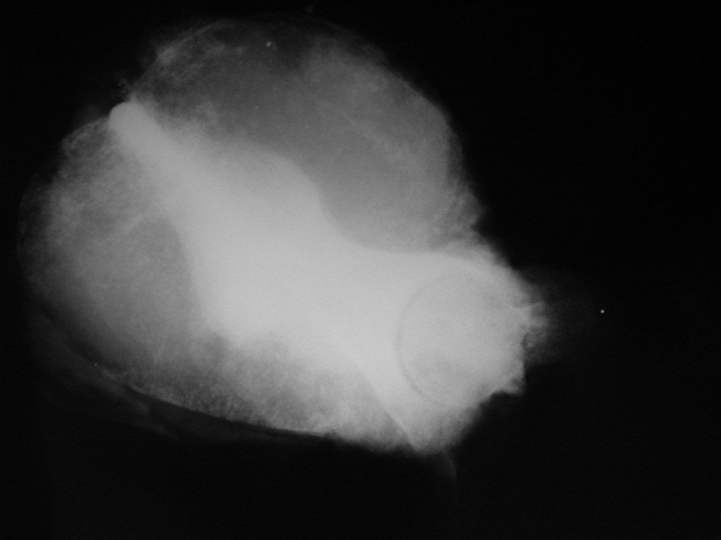 Figura 38: Radiografia da peça cirurgica, mostrando o acetábulo e a cabeça femoral ressecada em bloco.