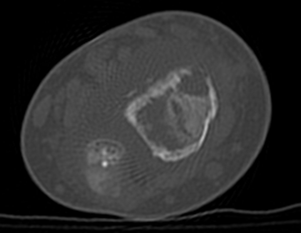 Figura 13: 2015-09-22 CT