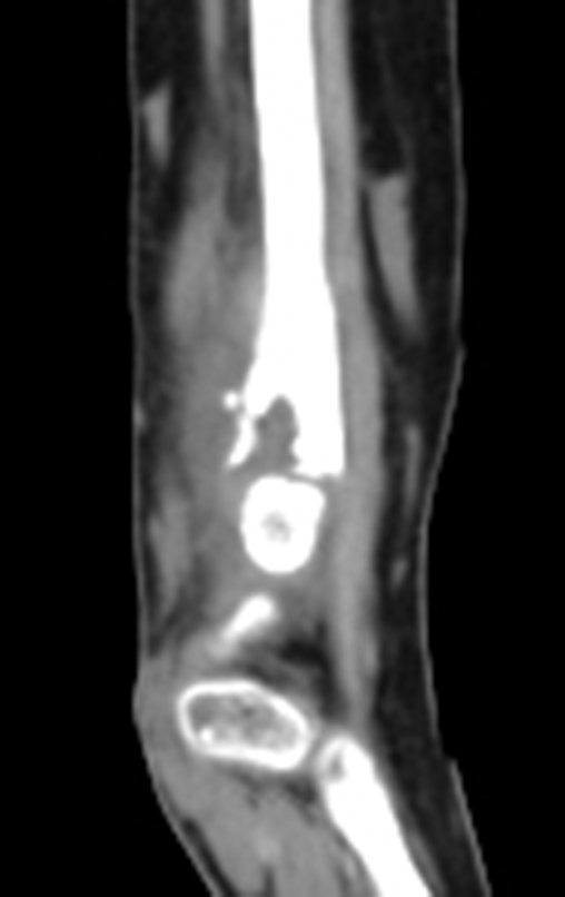 Figura 14: 2015-09-22 CT