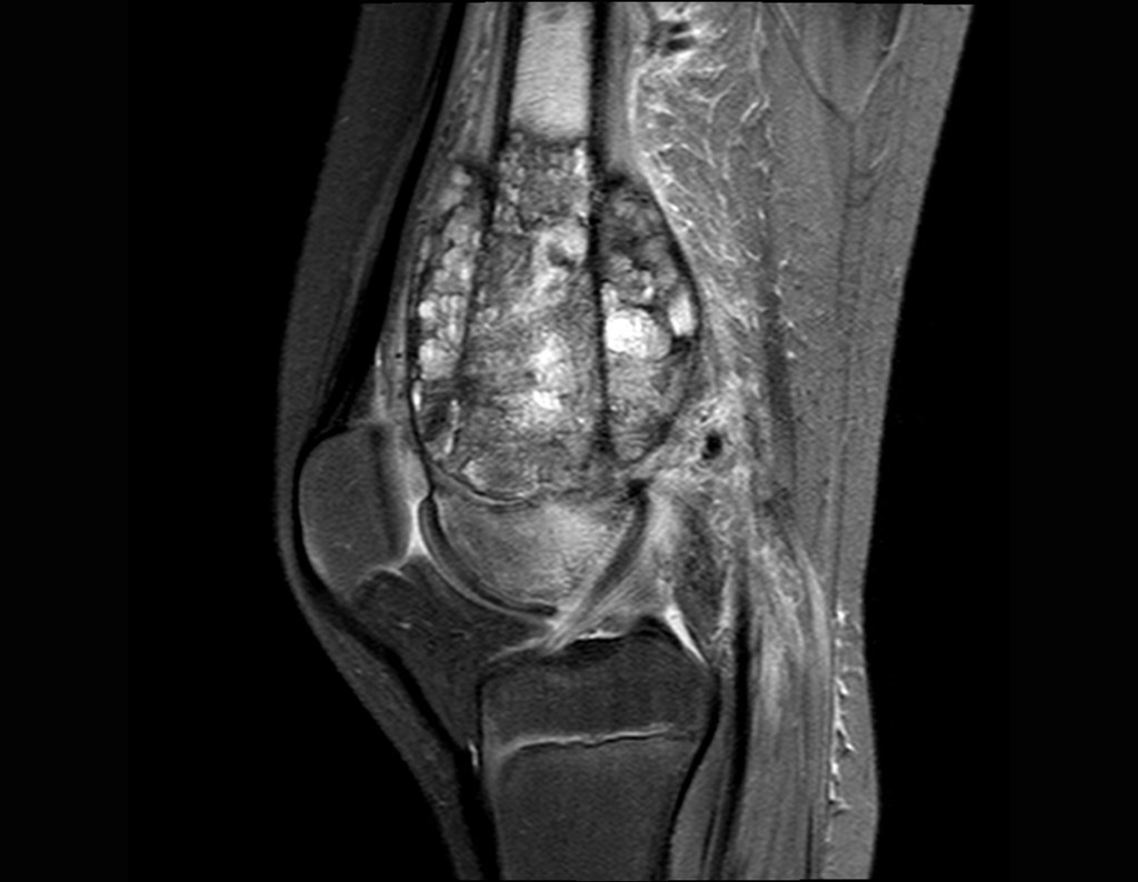 Figura 36: RM sag-T2-fat.
