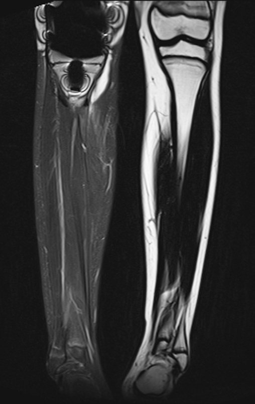 Figura 148: 2015-08-19_RM cor-T2-dixon.
