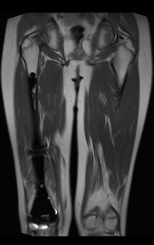 Figura 138: RM cor - dp - vat_2015-08-19.
