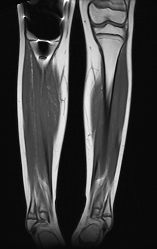 Figura 146: 2015-08-19_RM cor T1.