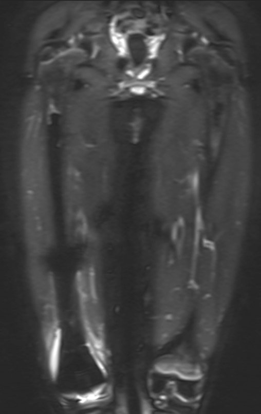 Figura 140: RM cor - stir - semac_2015-08-19.